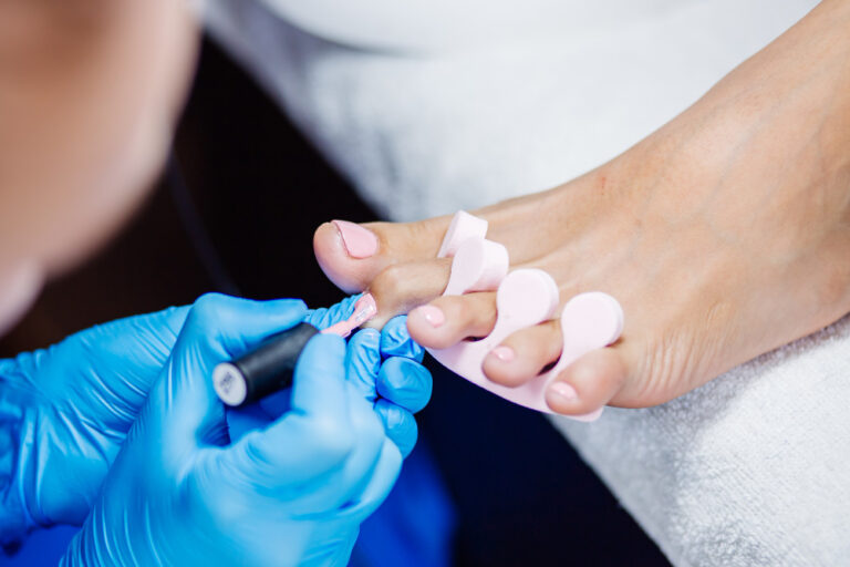 pedicure image